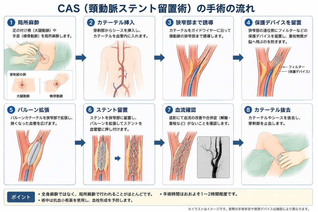 CASの流れ